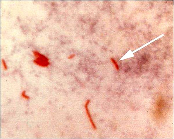 露出を減らすためにできること
