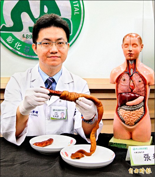 大腸包小腸 男大生「腸套疊」腹痛就醫
