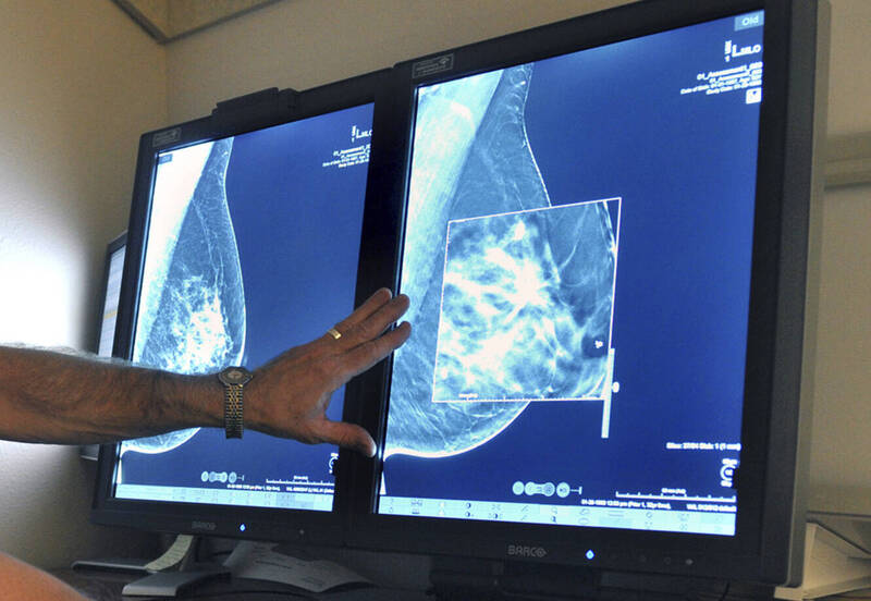 肺癌退居老二 WHO：乳癌成全球最常見癌症 - 即時新聞 - 自由健康網