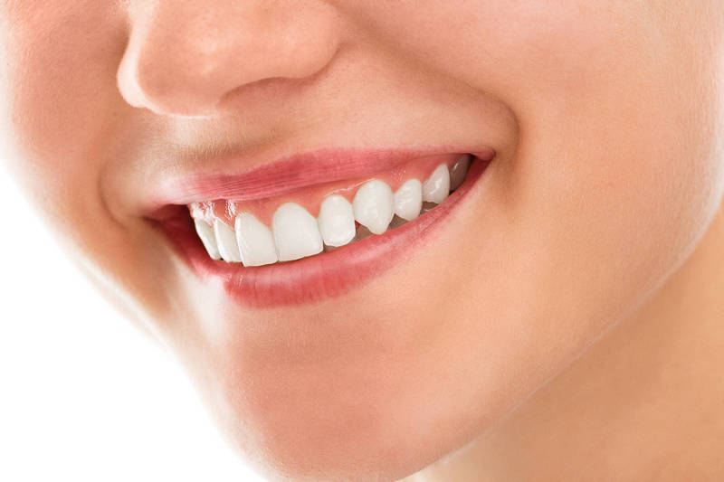 健康網》明星牙齒美白的秘密！ 醫解析全瓷貼片和全瓷假牙怎麼選 - 即時新