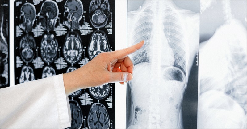 醫師指出，常接觸油煙、粉塵，罹患肺癌風險會大大升高。 （聯欣診所提供）