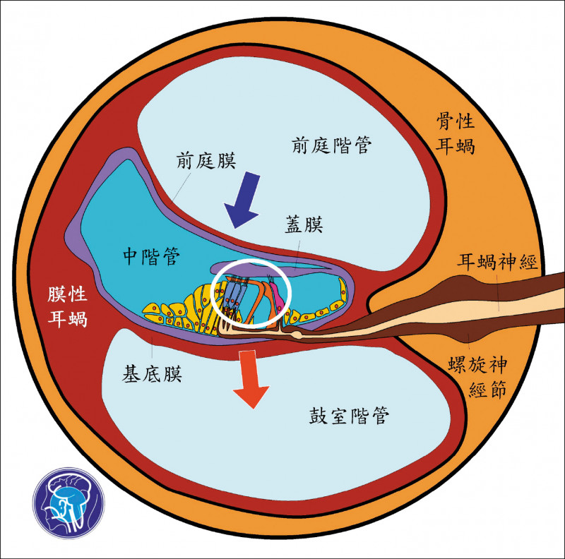 popping-noises-disturb-people-with-allergic-cochlear-lesions-breaking