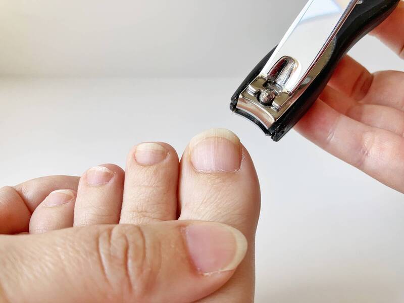 健康網》腳趾甲出現5變化應就醫！ 醫揭「它」常被誤認成灰指甲 - 自由健康網