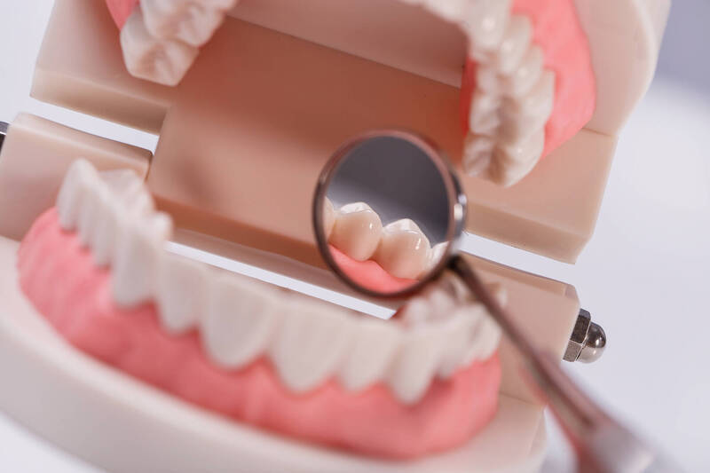健康網》缺牙恐影響咀嚼、說話、外觀與結構  醫揭「假牙」的四大功用 - 自由健康網