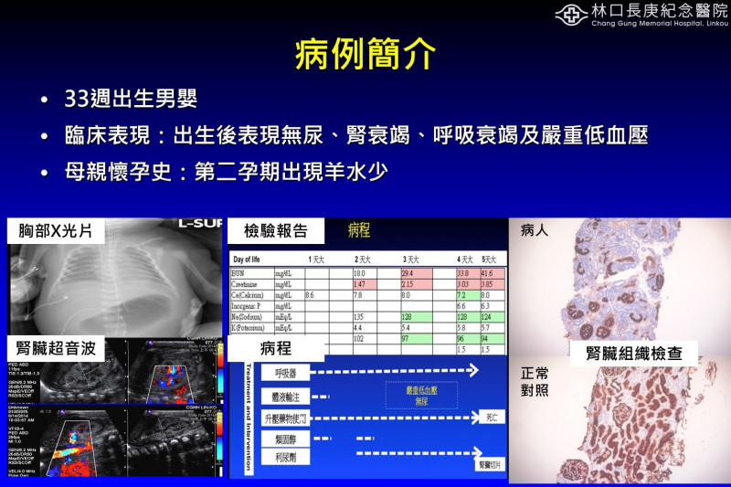 「自體隱性腎小管發育不良」是很罕見的遺傳性腎臟疾病，但新生兒一發病死亡率就近9成。（長庚醫院提供）