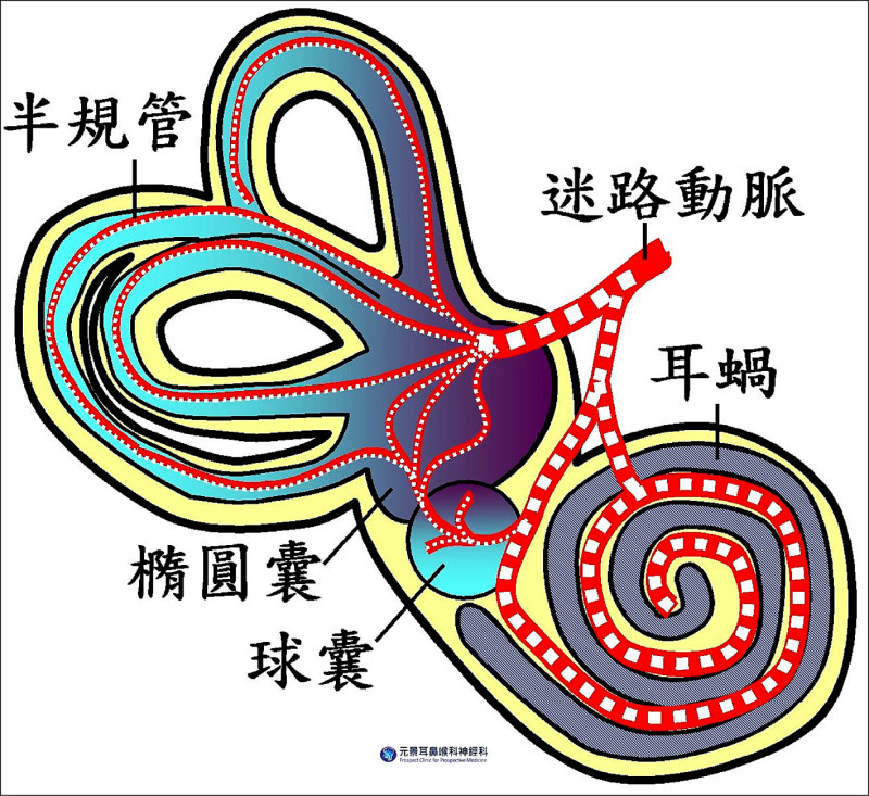 ▲圖1：糖尿病血管病變性內耳炎機轉。（照片提供／陳建志）