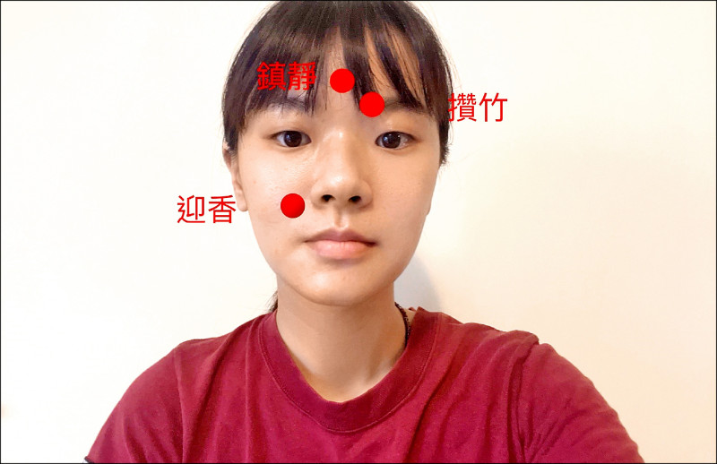 ▲中醫針灸穴位。（照片提供／黃彥融、姜智釗）