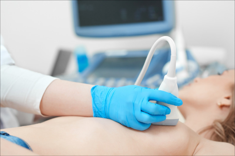 【健康新聞】乳房攝影搭乳房超音波 提高診斷準確率