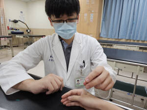 中醫師以合谷穴為病人針灸治療，有助於改善手腳無力。（馬偕醫院提供）
