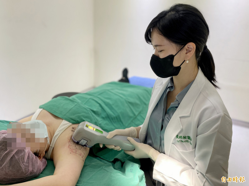 黃昭瑜主任運用無創miradry療法，破壞腋下汗腺，達到止汗、除味、不需動刀、無代償的效果。（記者陳建志攝）