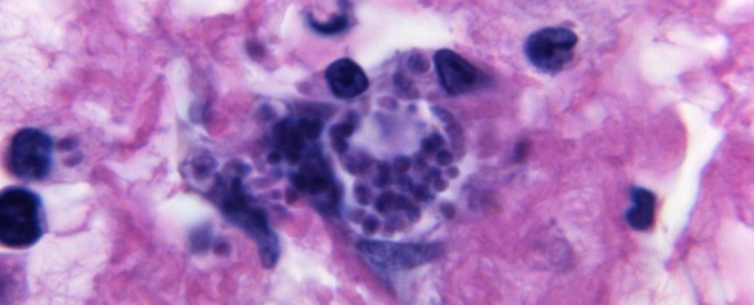 嚇！全球半數人恐中鏢 「弓形蟲」害精子身首異處