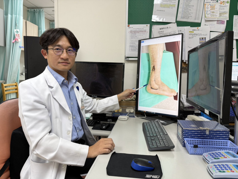 40歲女慢性外踝潰瘍且神經性疼痛  AI輔助皮瓣重建解痛