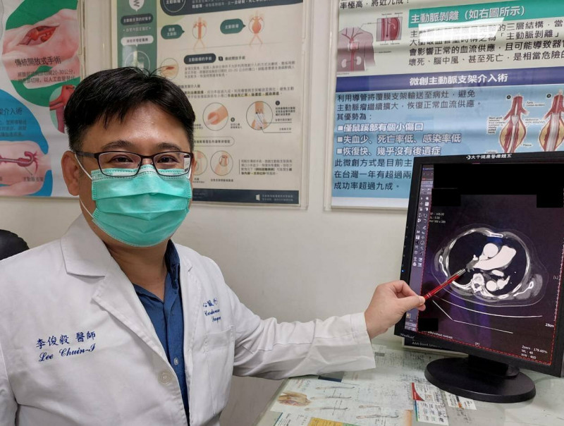 走路喘竟是肺動脈有大量血栓  醫籲別輕忽「沉默殺手」