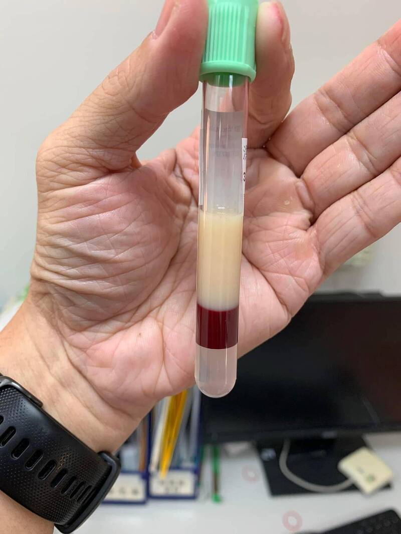 奇美醫院加護醫學部醫師陳志金在自己粉專PO抽血管,要病人注意,別讓胰臟炎上身。(取自陳志金臉書) 奇美醫院加護醫學部醫師陳志金在自己粉專PO抽血管,要病人注意,別讓胰臟炎上身。(取自陳志金臉書)