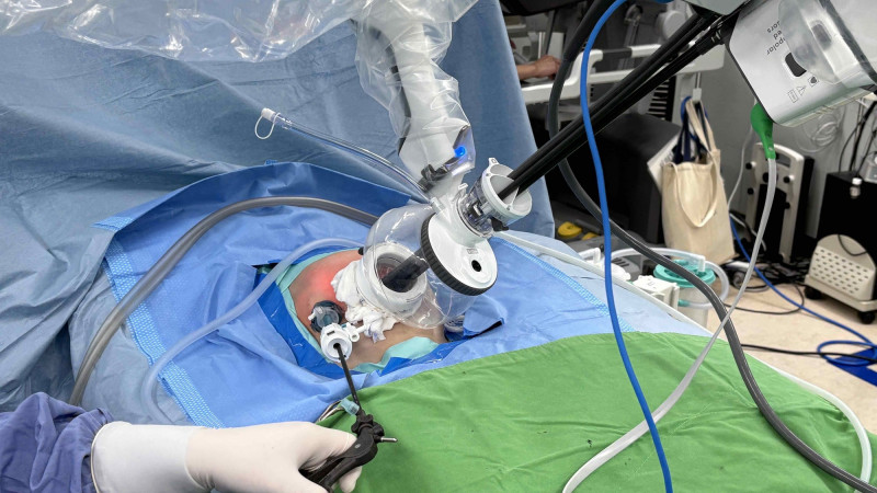 單孔達文西手臂總膽管囊腫手術,將腹部切口隱藏在肚臍內,幾乎不留疤痕。(記者蔡淑媛翻攝) 單孔達文西手臂總膽管囊腫手術,將腹部切口隱藏在肚臍內,幾乎不留疤痕。(記者蔡淑媛翻攝)