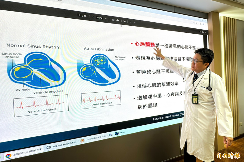 心臟內科醫師江承鴻說明心房顫動的病因與風險。(記者許麗娟攝) 心臟內科醫師江承鴻說明心房顫動的病因與風險。(記者許麗娟攝)
