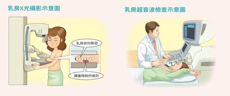 台大家醫科主治醫師粘曉菁指出,乳房攝影及乳房超音波是乳癌篩檢的兩大利器。(好心肝提供) 台大家醫科主治醫師粘曉菁指出,乳房攝影及乳房超音波是乳癌篩檢的兩大利器。(好心肝提供)