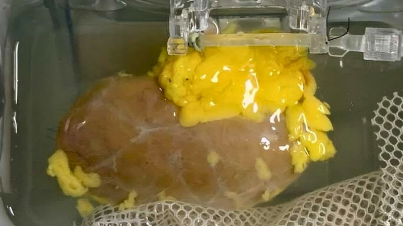 研究團隊在實驗室中,利用特殊酵素處理A型捐贈腎臟,以去除其血型抗原標記,將其轉化為可供任何血型患者使用的「萬能腎臟」。(圖取自《自然生物醫學工程》期刊) 研究團隊在實驗室中,利用特殊酵素處理A型捐贈腎臟,以去除其血型抗原標記,將其轉化為可供任何血型患者使用的「萬能腎臟」。(圖取自《自然生物醫學工程》期刊)