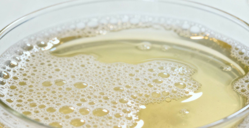 40歲女子健檢發現蛋白尿就醫,揪出罕見多發性骨髓瘤。(樂生醫院提供) 40歲女子健檢發現蛋白尿就醫,揪出罕見多發性骨髓瘤。(樂生醫院提供)