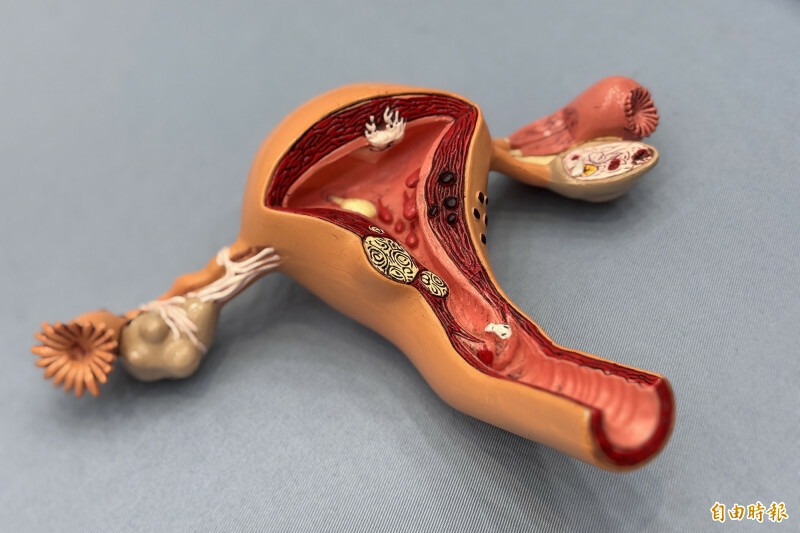 緊急事後避孕藥是否應從處方藥轉為指示用藥爭議多年未解。 (資料照,記者邱芷柔攝) 緊急事後避孕藥是否應從處方藥轉為指示用藥爭議多年未解。 (資料照,記者邱芷柔攝)