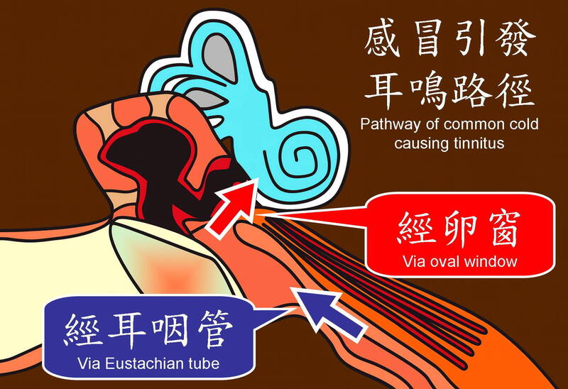 圖解說明感冒引起耳鳴的路徑。(陳建志提供) 圖解說明感冒引起耳鳴的路徑。(陳建志提供)