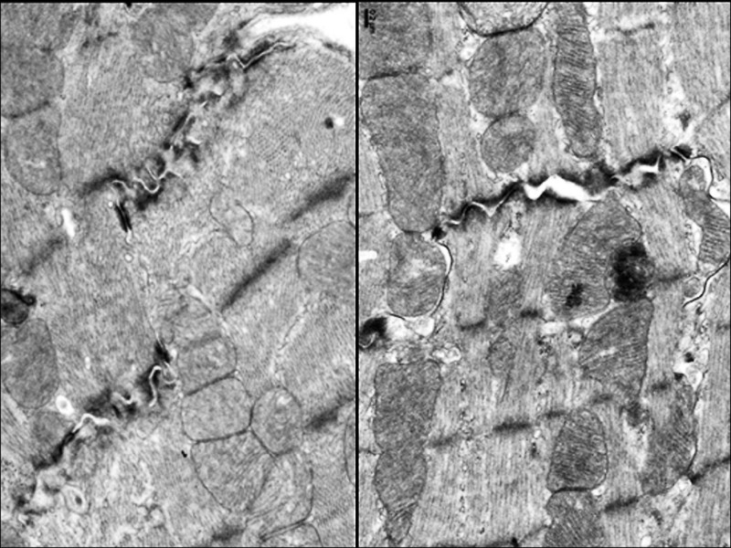 ▲左圖為使用「小紅莓」治療後的小鼠心肌細胞,黑色類似峽谷的地方為心肌受損;右圖使用橙皮素後可看見受損的地方慢慢復原。(陽明交大提供) ▲左圖為使用「小紅莓」治療後的小鼠心肌細胞,黑色類似峽谷的地方為心肌受損;右圖使用橙皮素後可看見受損的地方慢慢復原。(陽明交大提供)