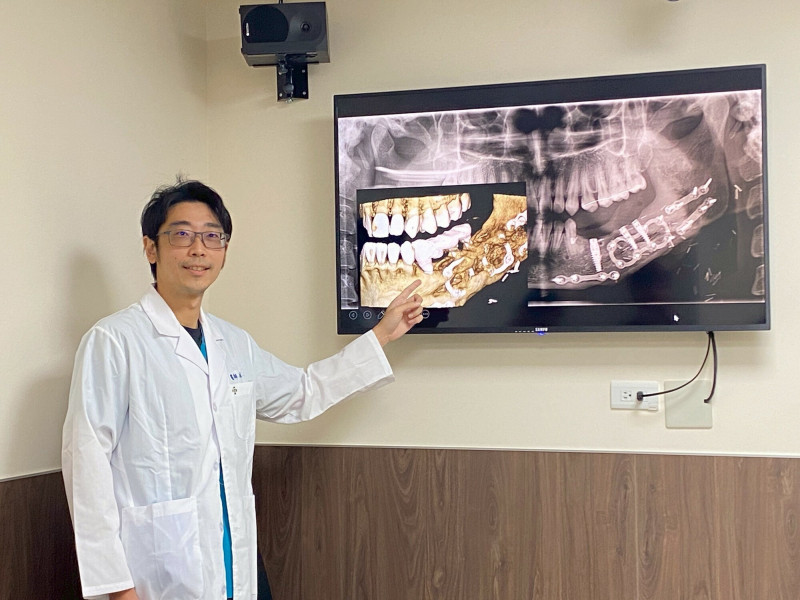 秀傳口腔顎面外科醫師林楠瑾,說明個案治療過程,切除腫瘤後取小腿腓骨骨段移植重建下顎,再植牙讓個案術後能恢復正常咀嚼與自然微笑。(彰化秀傳紀念醫院提供) 秀傳口腔顎面外科醫師林楠瑾,說明個案治療過程,切除腫瘤後取小腿腓骨骨段移植重建下顎,再植牙讓個案術後能恢復正常咀嚼與自然微笑。(彰化秀傳紀念醫院提供)