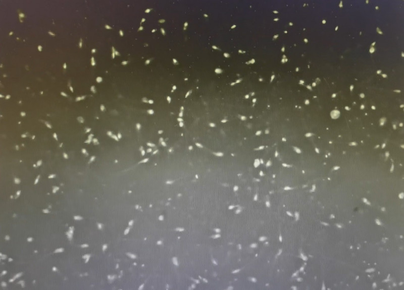 32歲運將生不出孩子 竟是糖飲喝太多所致