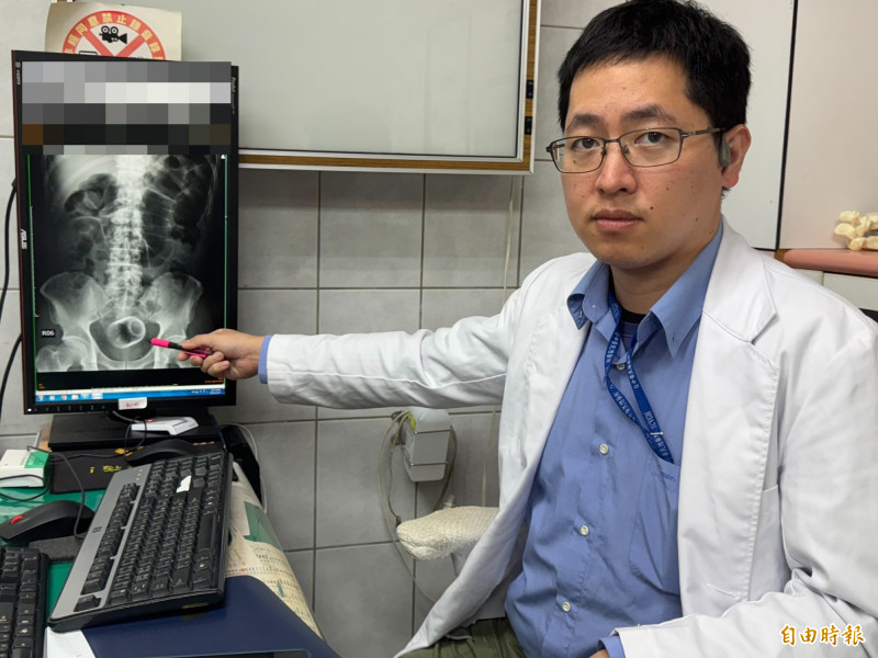 驚！瓷杯塞爆菊花 大叔3天難解便「破肚開腸」取出