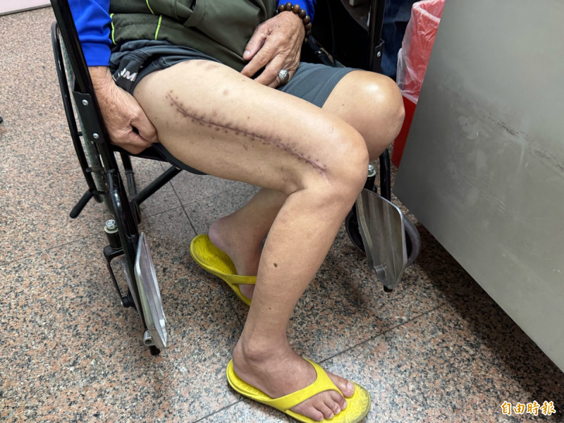 大甲媽頭旗隊8旬副團長車禍 腿斷3截！手術3次已能行走「繼續遶境」
