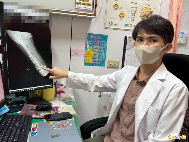 大甲李綜合醫院骨科醫師廖唯任使用髓內鋼釘為患者固定大腿。(記者張軒哲攝) 大甲李綜合醫院骨科醫師廖唯任使用髓內鋼釘為患者固定大腿。(記者張軒哲攝)