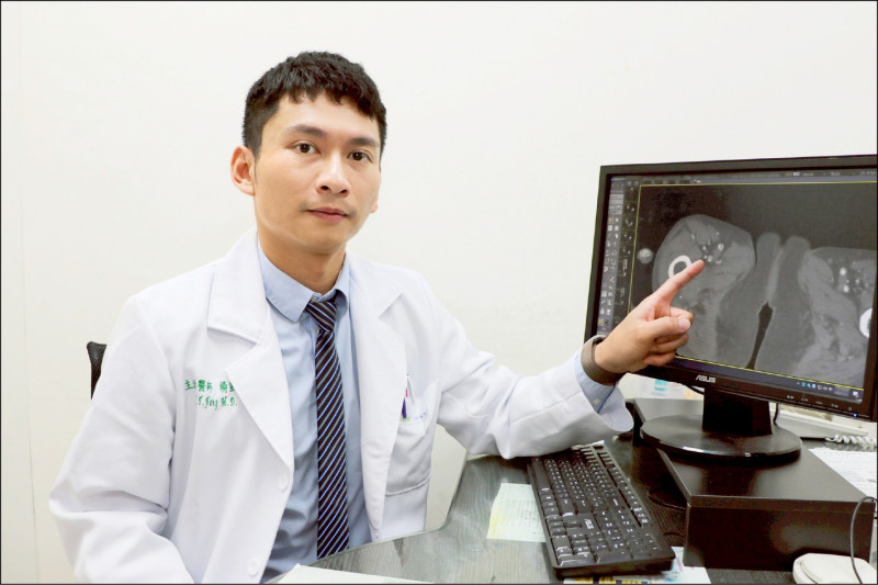 ▲楊凱迪醫師說明,患者的下肢刺痛是因血管老化病變而阻塞。(聯新國際醫院提供) ▲楊凱迪醫師說明,患者的下肢刺痛是因血管老化病變而阻塞。(聯新國際醫院提供)