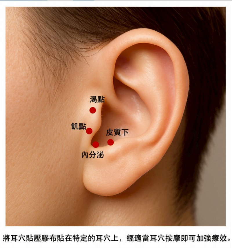 糖尿病長期血糖控制不佳 耳穴保健、中藥調理助控管