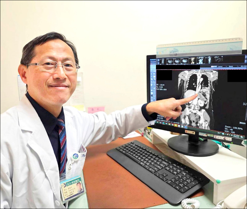 重大車禍致「胃腸擠入胸腔」 腹腔鏡微創術搶回一命