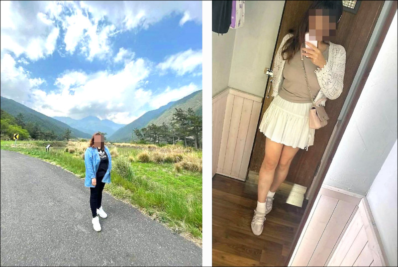 女子胃夾手術成功減肥70公斤