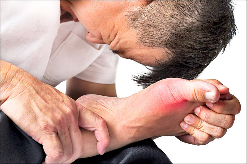 內分泌新陳代謝專科醫師蔡明劼指出,研究發現,痛風患者若能將尿酸控制在一定數值以下,心梗、中風風險可降低23%;情境照。(照片來源:shutterstock) 內分泌新陳代謝專科醫師蔡明劼指出,研究發現,痛風患者若能將尿酸控制在一定數值以下,心梗、中風風險可降低23%;情境照。(照片來源:shutterstock)