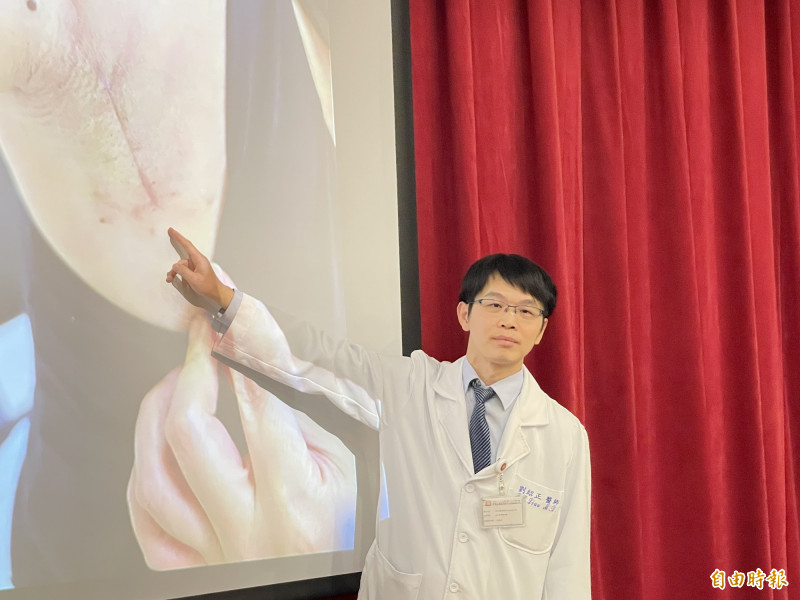 切除甲狀腺腫瘤、頸部不留疤 三總新技術兼顧神經與外觀