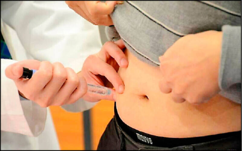 減肥手術後肌肉流失近12％ 研究：吃藥也一樣