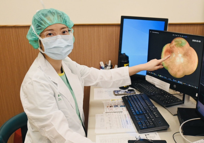 傳統眼底檢查恐漏看 超廣角攝影一網打盡眼底影像