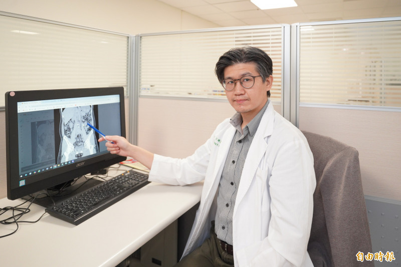 雙側腎結石高風險 軟式輸尿管鏡逆行性腎臟內取石手術取出36顆結石