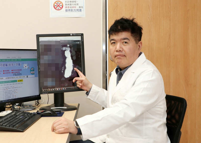 近百歲人瑞腹部主動脈瘤快破裂 微創主動脈支架置放術搶命
