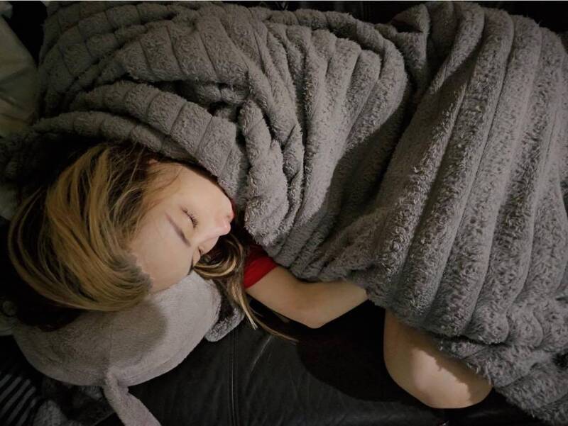 健康網》雪碧曝跌倒致腦震盪內幕！ 醫：這些人不適合抽脂