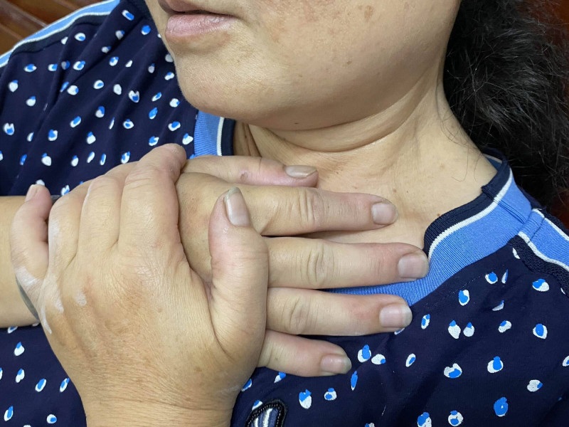 50歲男長期喝烈酒吞嚥「卡卡」  就醫竟罹食道癌