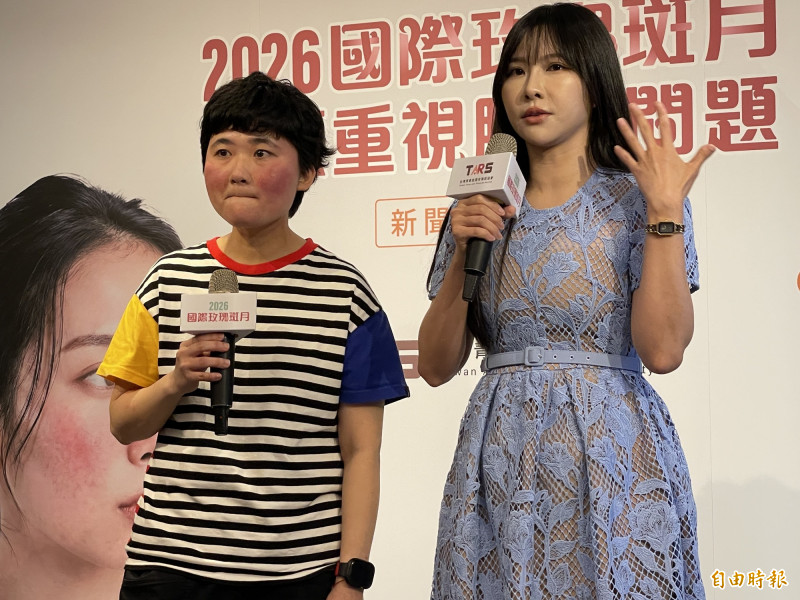 臉紅誤當異位性皮膚炎拖6年 30歲女確診玫瑰斑哽咽謝醫