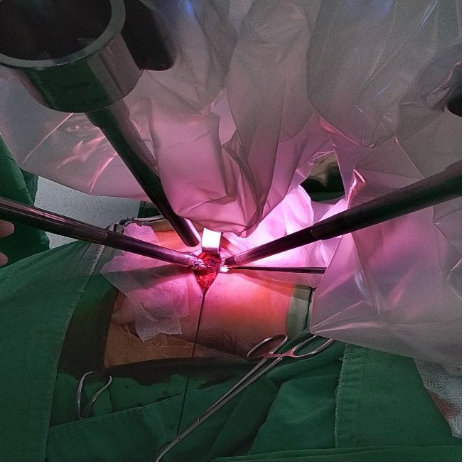 耳後摸到硬塊當心腮腺腫瘤  及早檢查治療更有效