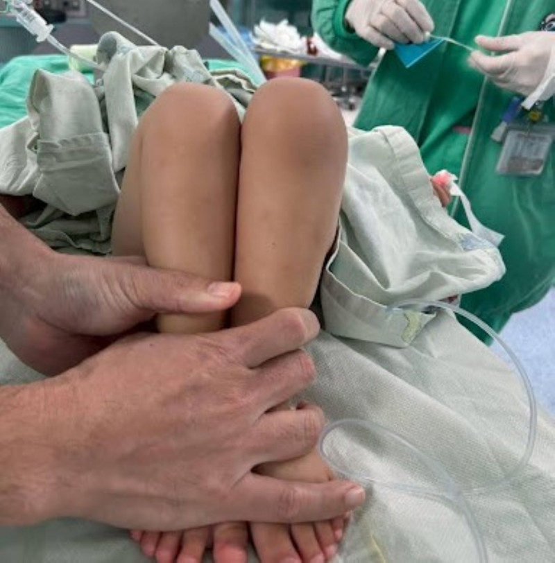 11個月大女童右腳拖行確診髖關節發育不良  嘉基一站式照護獲認證