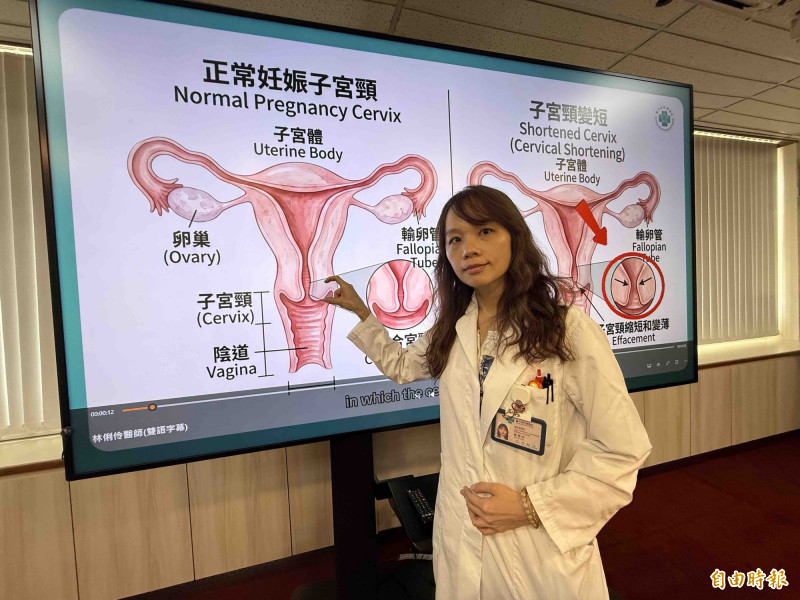 陳雅芳醫師指出,子宮頸閉鎖不全是導致中期流產與早產的重要原因,每10名早產就有1個是子宮頸閉鎖不全造成。(記者蔡淑媛攝) 陳雅芳醫師指出,子宮頸閉鎖不全是導致中期流產與早產的重要原因,每10名早產就有1個是子宮頸閉鎖不全造成。(記者蔡淑媛攝)