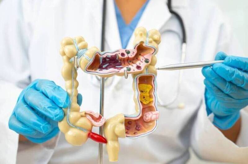 研究指出,在年輕族群中,大腸癌中的直腸癌死亡率上升速度更快,且症狀常被誤判,導致延誤就醫情形普遍。;示意圖。(圖取自shutterstock) 研究指出,在年輕族群中,大腸癌中的直腸癌死亡率上升速度更快,且症狀常被誤判,導致延誤就醫情形普遍。;示意圖。(圖取自shutterstock)
