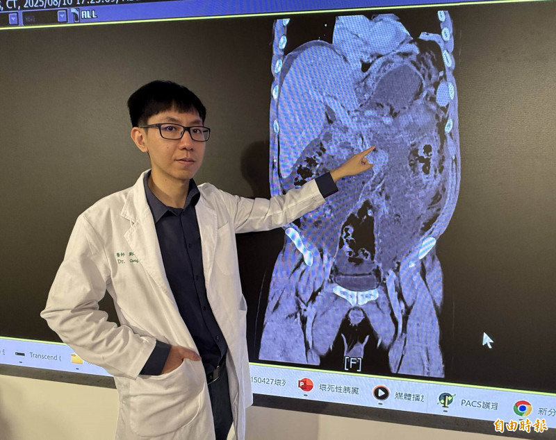 鄭智忠醫師指許先生罹患壞死性胰臟炎,已經敗血性休克。(記者蔡淑媛攝) 鄭智忠醫師指許先生罹患壞死性胰臟炎,已經敗血性休克。(記者蔡淑媛攝)