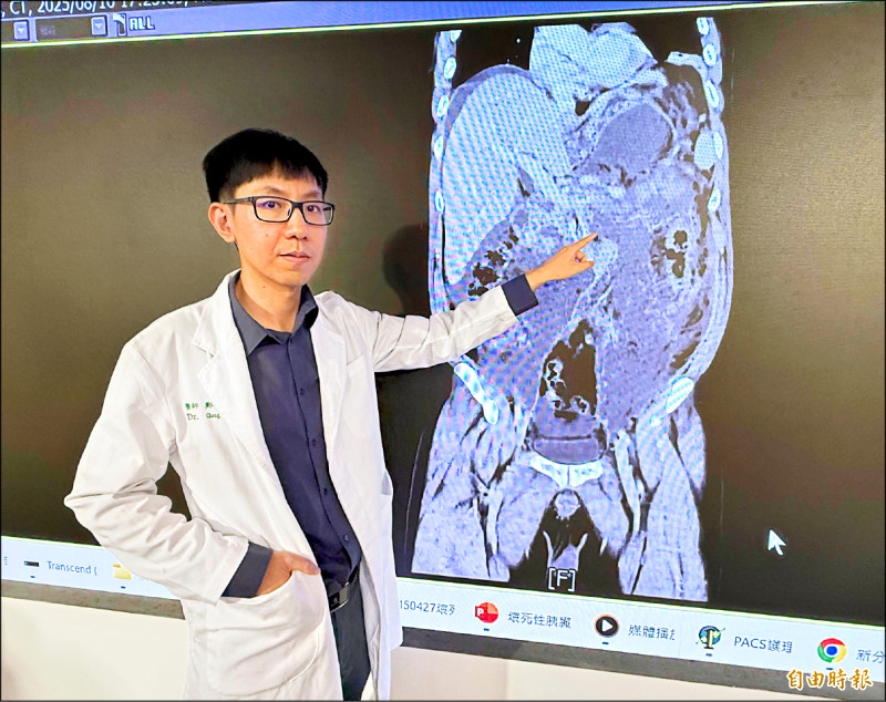 ▲鄭智忠醫師指許先生罹患壞死性胰臟炎,造成敗血性休克。(記者蔡淑媛攝) ▲鄭智忠醫師指許先生罹患壞死性胰臟炎,造成敗血性休克。(記者蔡淑媛攝)
